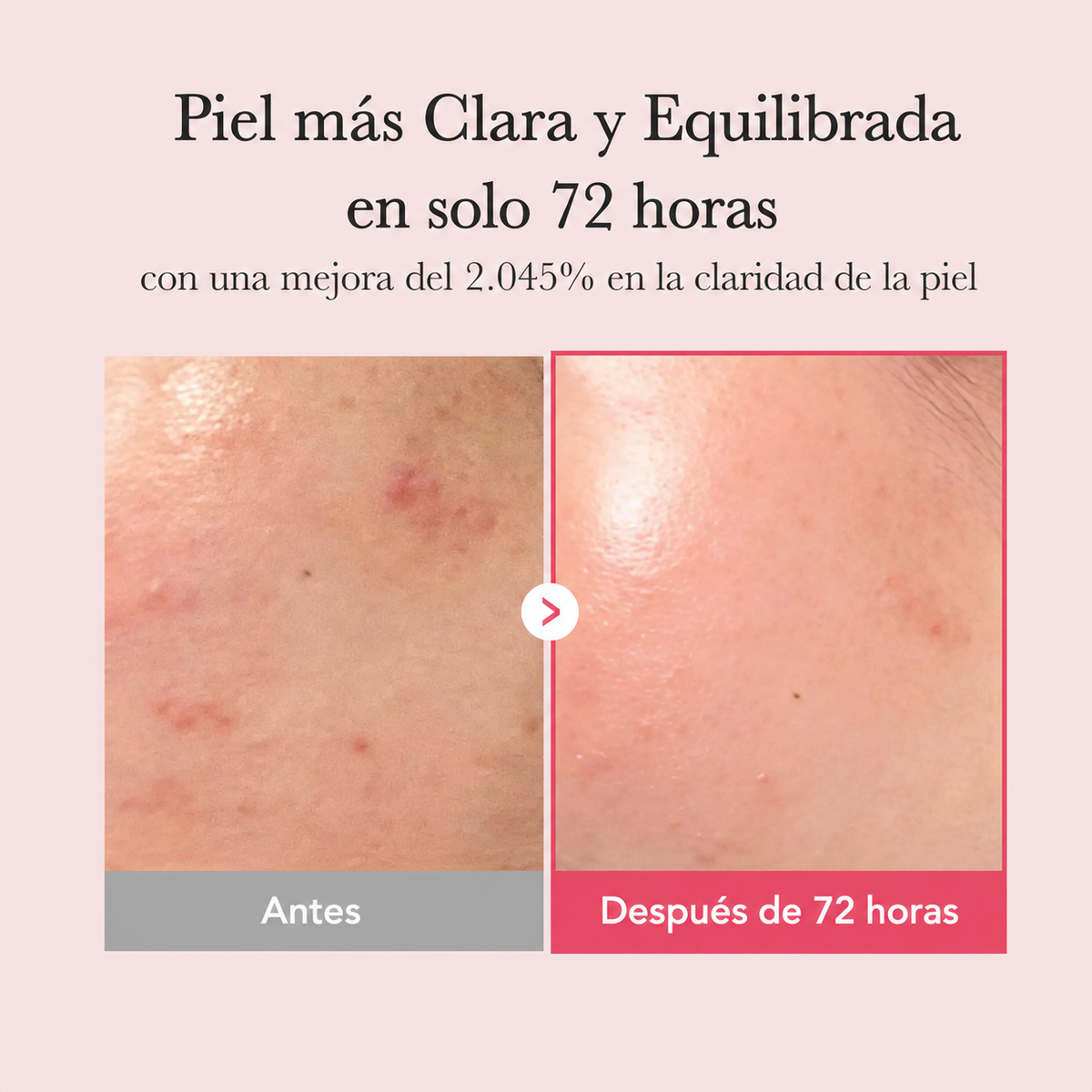 Serum TXA Niacinamida 30 ml. - Medicube