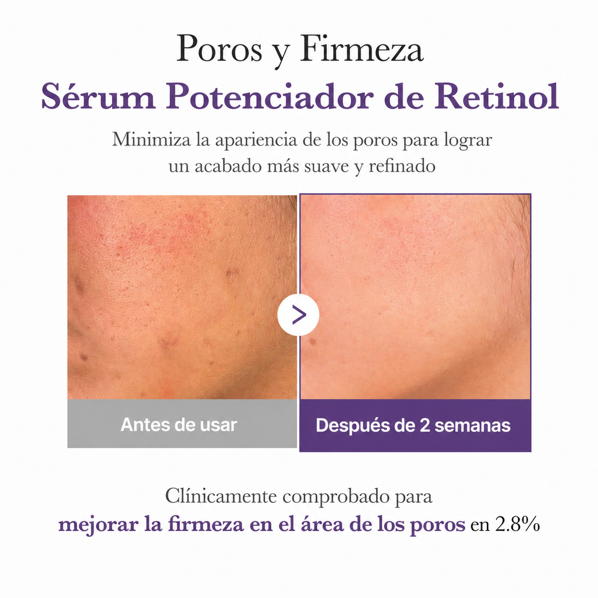 Serum Potenciador Retinol NMN 30 ml. - Medicube