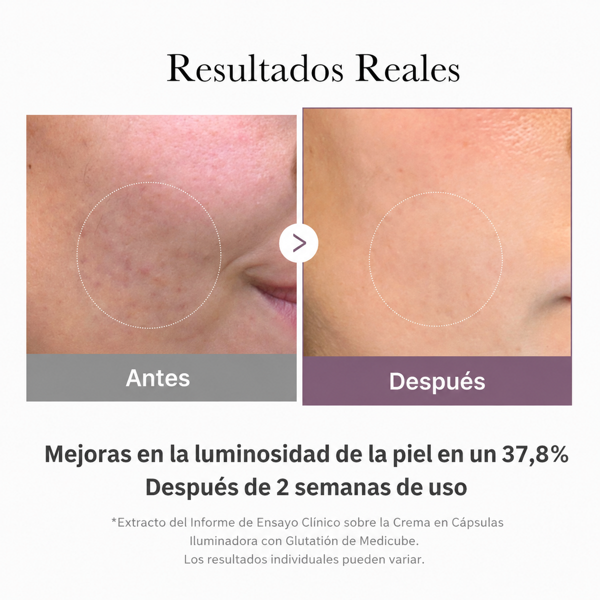 Crema Facial en Cápsulas AGE-R con Glutation - Medicube